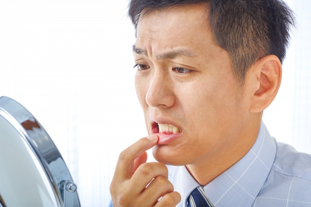 何度もできやすい口内炎。タイプでわかる口内炎の原因と治療方法 | 歯科コラム | 周南市久米の歯医者「ひだまり歯科医院」一日100名以上が来院
